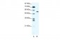 RUNX2 antibody - middle region